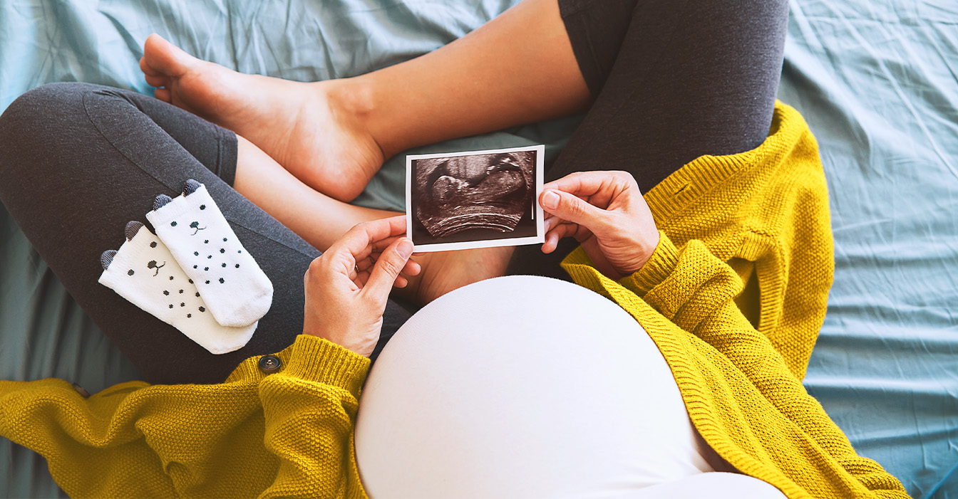  Schwangere Frau hält Ultraschallbild ihres Babys, während sie auf einem Bett sitzt.